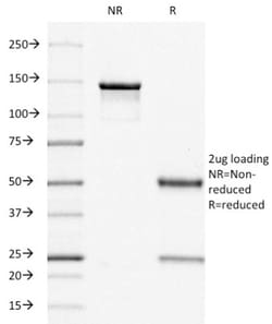 ER alpha/NR3A1 Antibody (ER505), Novus Biologicals 0.2mg; Unlabeled:Antibodies,